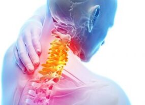 Pain and shelters in the cervical zone with a third degree of osteochondrosis
